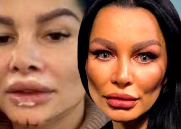 Care e motivul pentru care Brigitte Pastramă și-a făcut 20 de operații estetice. E pur și simplu șocant