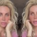Andreea Bănică suferă de probleme de sănătate. Ce diagnostic a primit artista