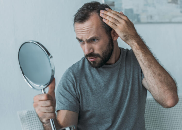 Alopecie – 3 cauze frecvente și ce poți face