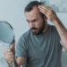 Alopecie – 3 cauze frecvente și ce poți face