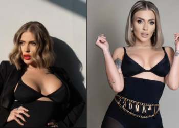 Oana Radu și-a făcut o nouă intervenție chirurgicală estetică!