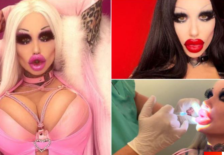 Și-a băgat 3kg de silicon în corp pentru a arăta ca păpușa Barbie!