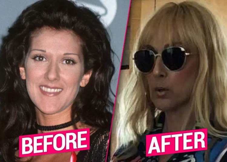 Celine Dion suferă de o boală foarte rară! „Mă doare și să vă spun!”