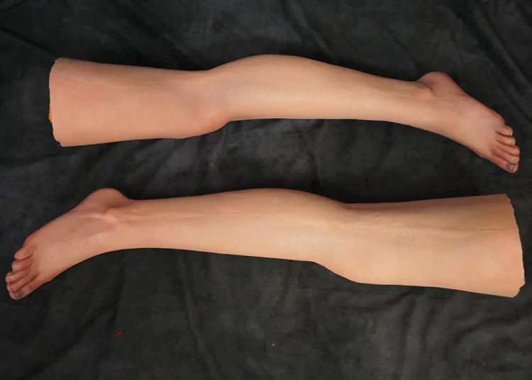 De ce acești oameni şi-au amputat picioarele lor sănătoase?