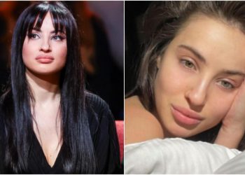 Cum arată Yana după operația de rinoplastie? Tânăra s-a dus până în Armenia după chirurgul estetician!