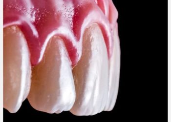 Tratamente stomatologice pentru gingii inestetice