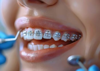 Ortodonție pediatrică: De ce vârsta de 7 ani este esențială pentru dinții copilului tău?